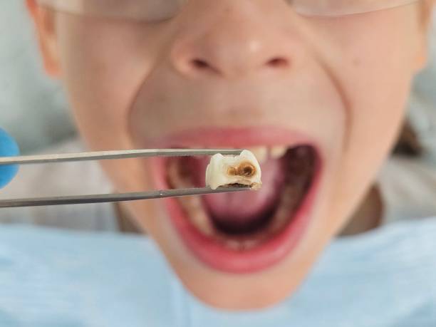 Professional Emergency Dental Service in NC